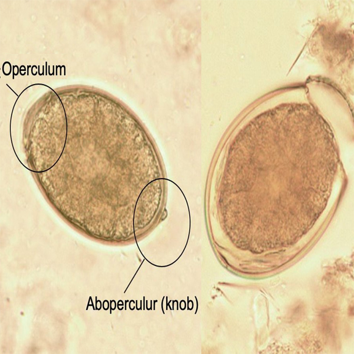 Tapeworm Diphyllobothrium latum